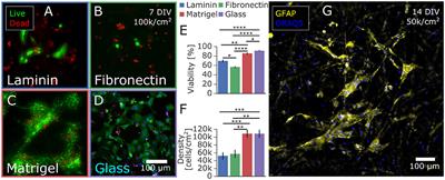 Simple and Inexpensive Paper-Based Astrocyte Co-culture to Improve Survival of Low-Density Neuronal Networks
